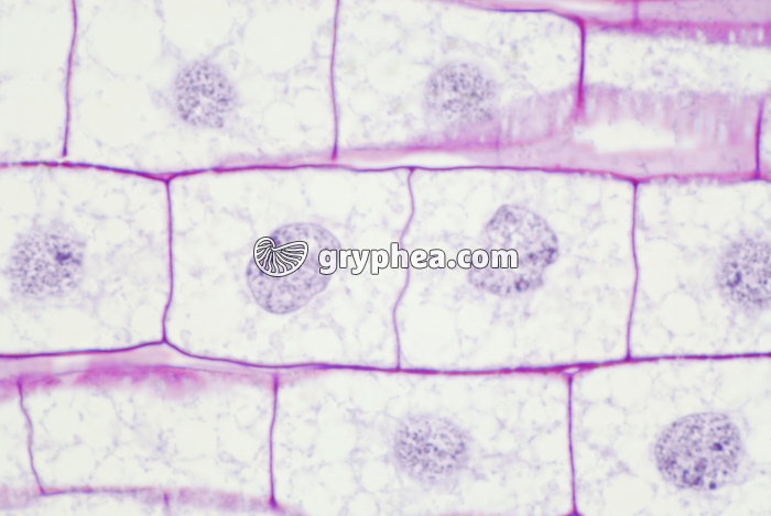 Mitose dans une racine de Blé (fin de télophase avec cellules-filles) x200 - gryphea.com